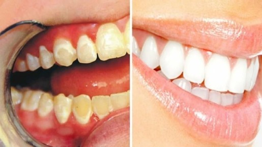 ��� ��������� ������: ������� ������ � ������ ������