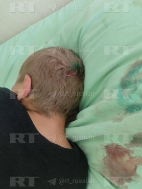 ��������� �������������� ���������, ��� ������ ������ �������, �������� ��������� �� ������