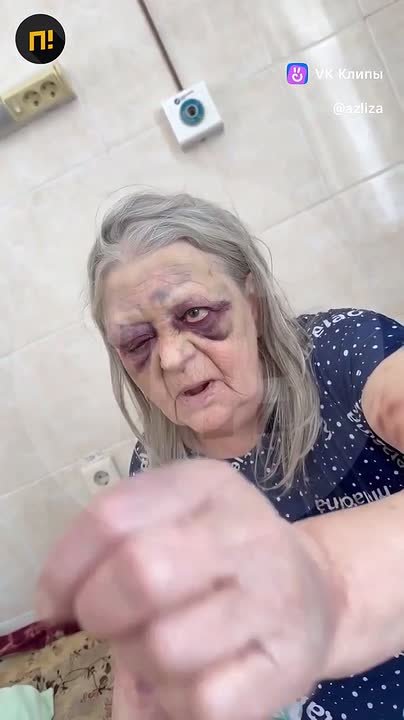 Минздрав Кузбасса пообещал «эффективное лечение» 76-летней пациентки, которая пожаловалась на избиение в больнице