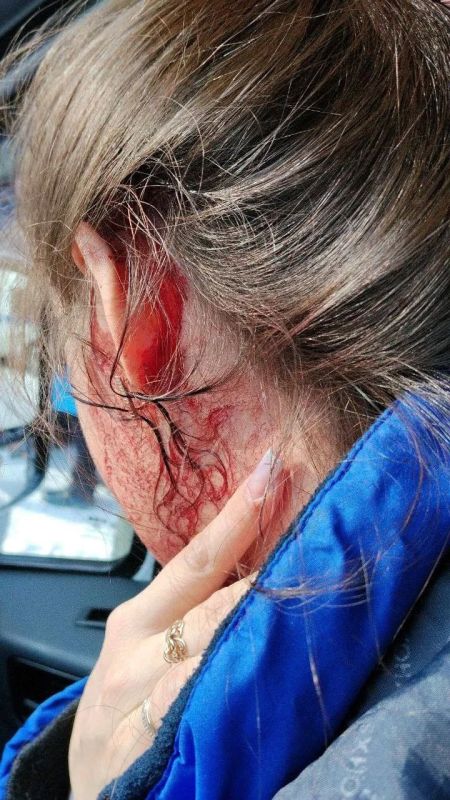 Пьяные женщины избили сотрудников скорой помощи, которую сами и вызвали